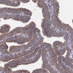 Arylsulfatase D Antibody, Novus Biologicals 0.1mL; Unlabeled:Antibodies,